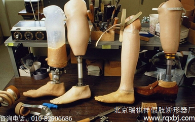 小腿假肢接受腔該如何選擇,都有哪些種類