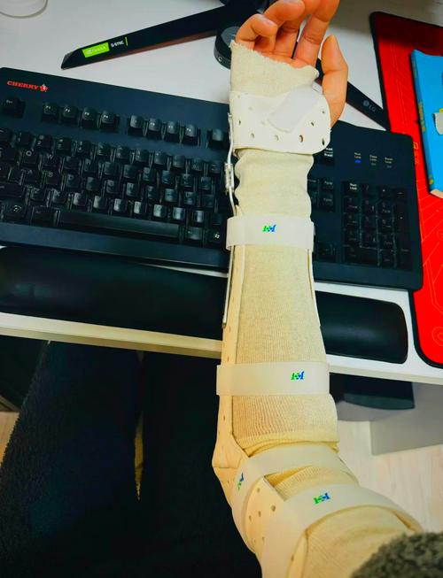 tfcc損傷康復(fù)日記:短臂支具的奇妙效果